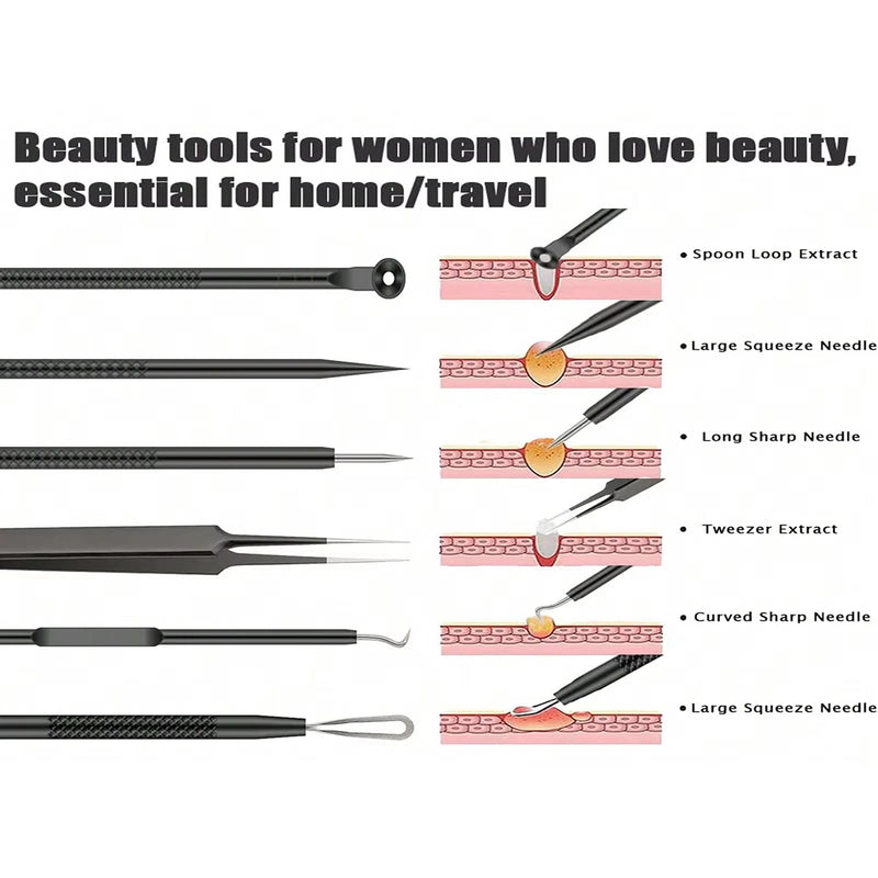 Kit Removedor de Cravos e Espinhas – Ferramentas para Acne